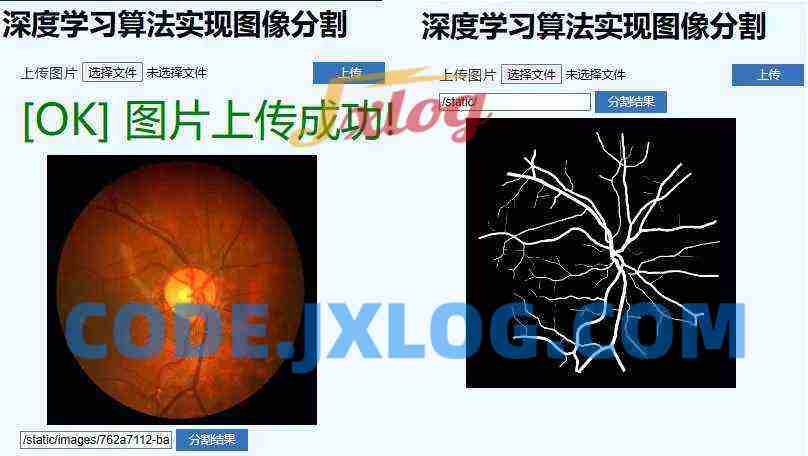 医学影像与图像分割:深度学习项目课 医学影像与图像分割:深度学习项目课